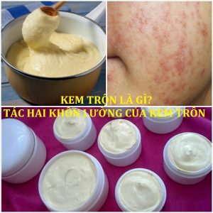 Danh sách 57 loại kem trộn gây hư tổn da mà chị em cần biết